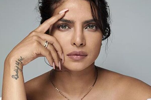 Priyanka Chopra Gets Injured On The Bluff Set, Calls It 'Professional Hazard'