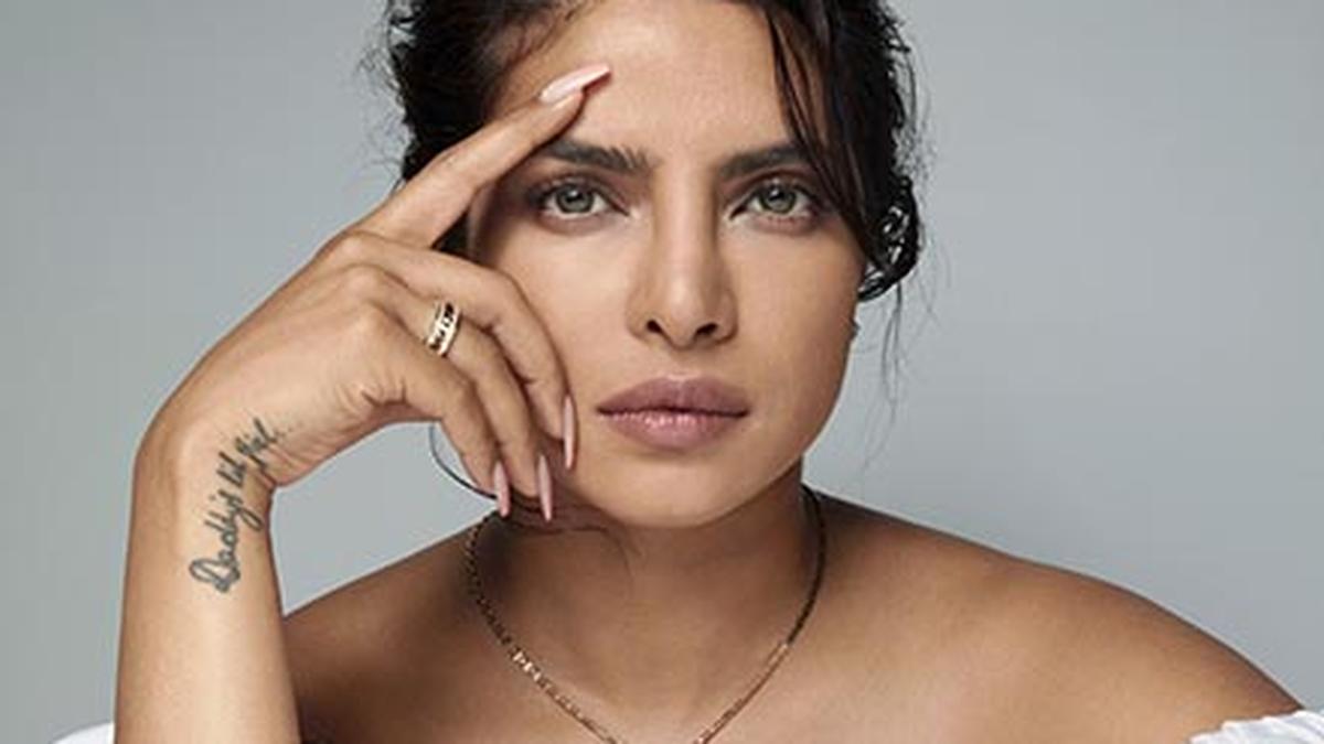 Priyanka Chopra Gets Injured On The Bluff Set, Calls It 'Professional Hazard'